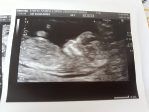 dar à luz em Madrid